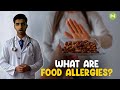 What are food allergies  metahealth