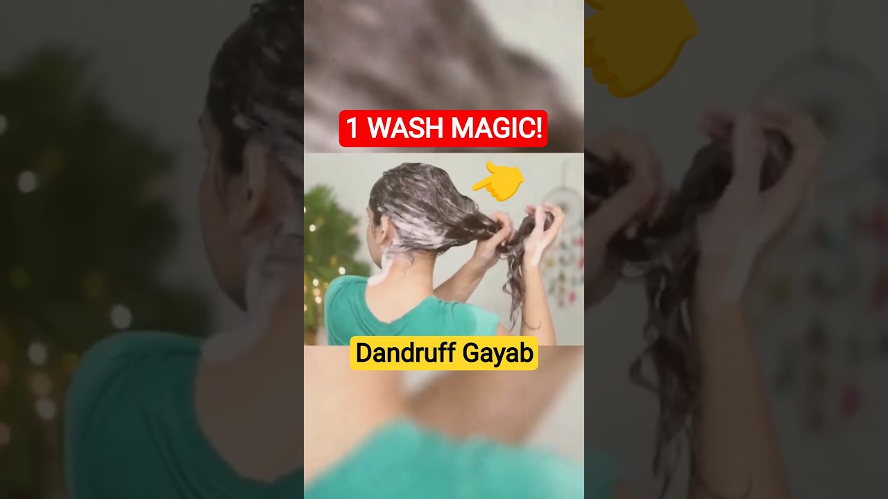 1 Wash Mein Dandruff Gayab! 😱#Dandruff#RemoveDandruff#DandruffTreatment#HairCare#HealthyScalp