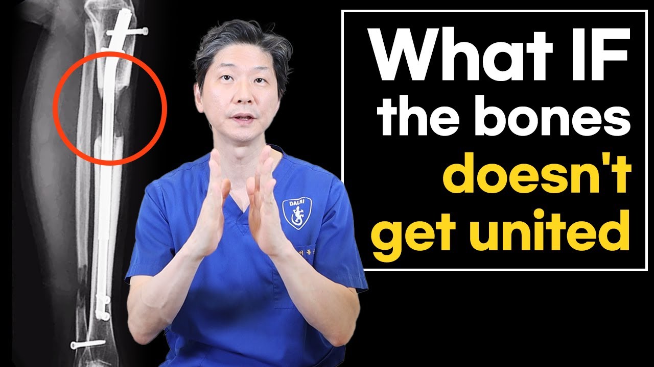 [ENG] Causes and Solutions: Why Aren't My Bones Forming Well After Lengthening Surgery?