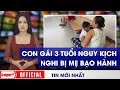 Đau xót bé gái 3 tuổi NGUY KỊCH, nghi bị MẸ ĐỂ bạo hành gây chấn thương