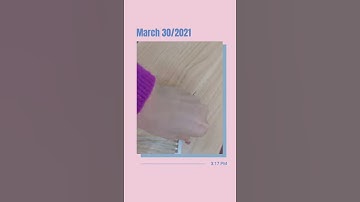 Vertical die casting machine