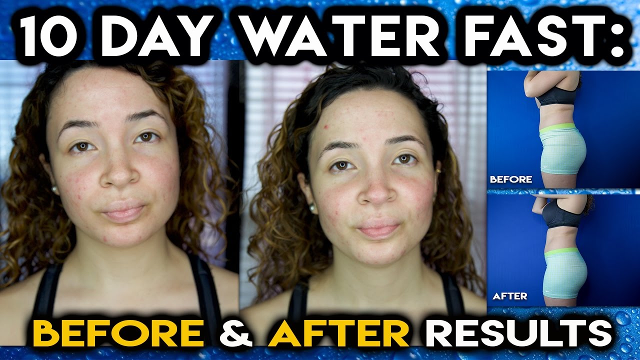 10 DAY WATER FAST | No food for 10 Days - YouTube