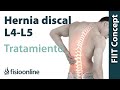 Tratamiento de hernia discal L4 y L5 derecha o cuarta y quinta vértebra lumbar