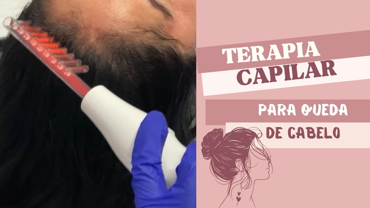 Terapia capilar, protocolo para queda de cabelo!