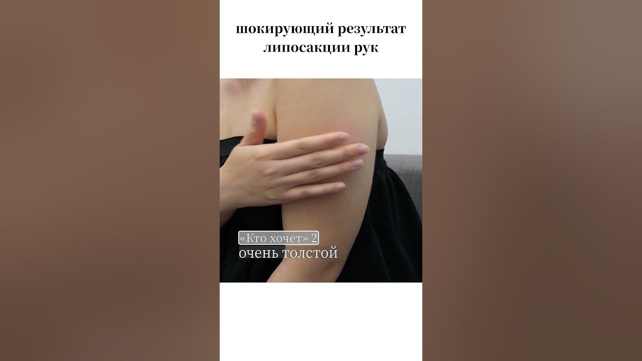 Клиника до и после отзывы Тамара Тулупова Красота, Услуги парикмахеров, Процедуры для волос, Орёл, Завод