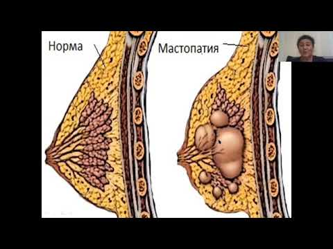 Video: Ko'krak Bilan Qoplangan Ayollar