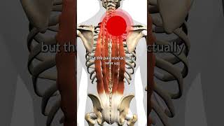 Erector Spinae Trigger Points Resimi
