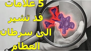 5 من أهم أعراض سرطان العظام | هل لديك أحد هذه العلامات