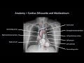 How to Interpret a Chest X-Ray (Lesson 2 - A Systematic Method and Anatomy)