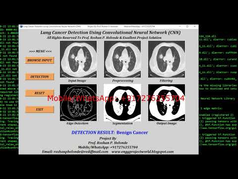 Lung Cancer Detection Using Python Opencv | Lung Nodule Classification Using Machine Learning Code