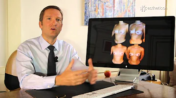 Comment se faire grossir les seins sans chirurgie ?