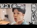 ほっぺの腫れがヤバ過ぎたので緊急で手術してきました!!!