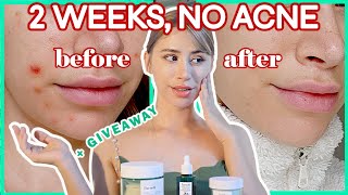 💦 CLEARED MY ACNE IN 2 WEEKS WITH A HONEY SKINCARE ROUTINE! 💥 Parnell Beauty skincare