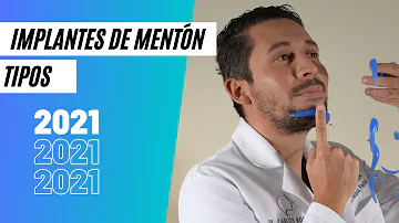 ¿El implante de mentón mejora la mandíbula?