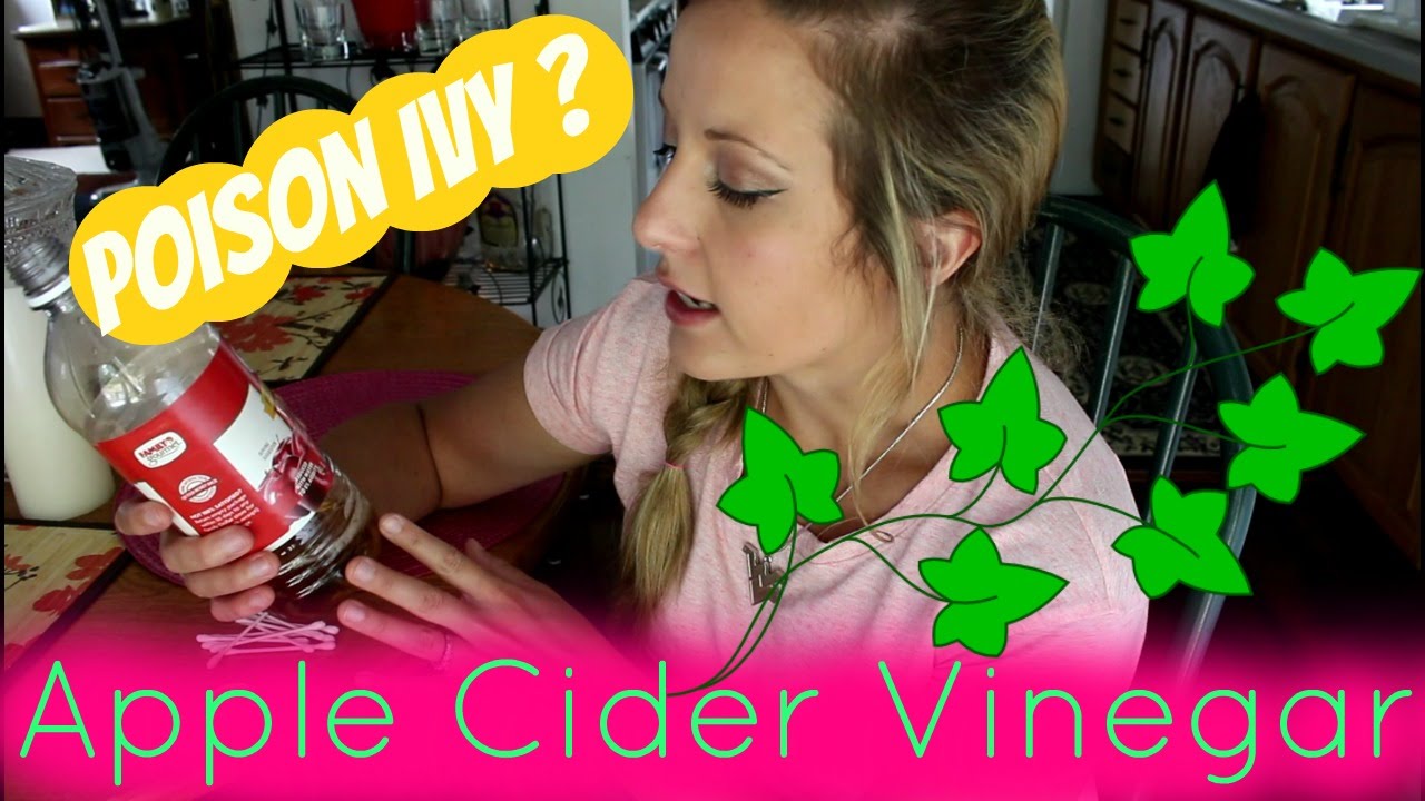 Using Apple Cider Vinegar to treat poison Ivy or Oak?! - YouTube