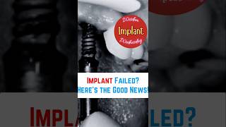 Agar Dental Implant Fail Ho Jaye Toh? 🤔 | Wisdom Implant Wednesday | Dr. Raut Dental Clinic Nagpur