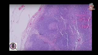 Lymphnode (normal) - Histopathology