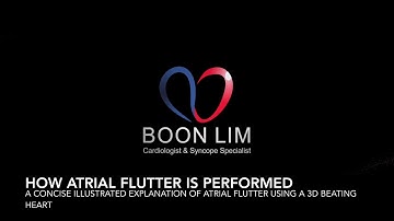 Atrial Flutter Ablation : A concise illustrated video explaining how atrial flutter is performed.