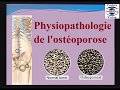 Physiopathologie de l'osteoporose fragilité osseuse osteopathie du dos cours de rhumatologie