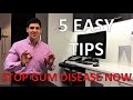 HOW TO STOP GUM DISEASE AND BLEEDING AT HOME (Fix Gingivitis And Gum Pain, 5 Simple Steps)