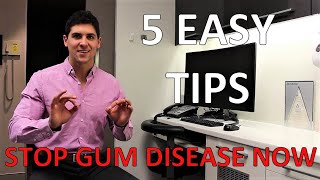 HOW TO STOP GUM DISEASE AND BLEEDING AT HOME (Fix Gingivitis And Gum Pain, 5 Simple Steps) by Dr Paul's Dental World 209,930 views 4 years ago 5 minutes, 54 seconds