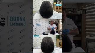 Muazzam Bir Sonuç Daha Geldi 🤗