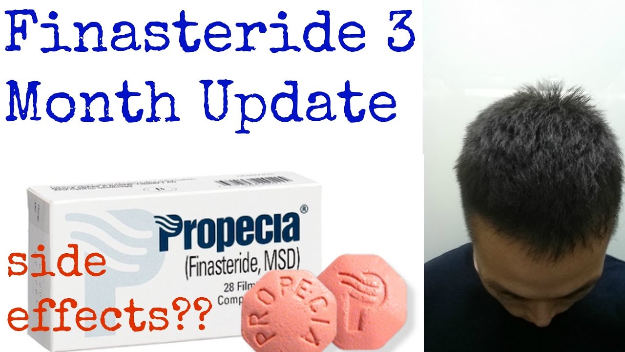 does taking more finasteride help