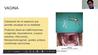 Exploración Física del Aparato Reproductor Femenino Exploración Física del Aparato Reproductor Femenino