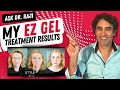 MY All Natural EZ GEL Under Eye RESULTS Eye Bags 