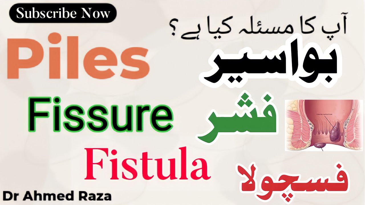 Difference between piles Fissure Fistula Urdu/Hindi Hakeem Sajjad Nizami Dawakhana YouTube