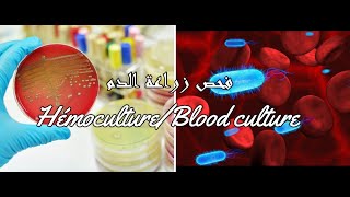 فحص زراعة الدم Hémoculture, Blood culture للبحث عن تسمم الدم جراء التهاب بكتيري او طفيلي