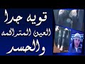 قوية جدا لكل من يعاني من العين المتراكمة والحسد محمد وكيل