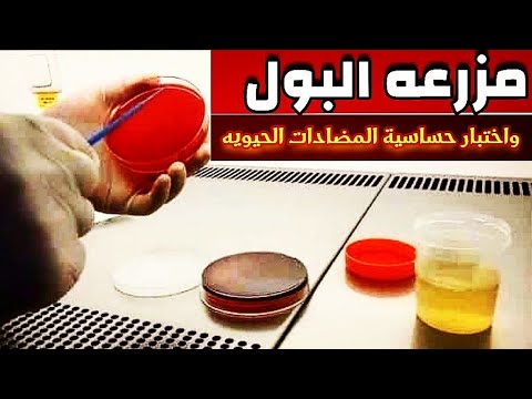 تحليل مزرعه البول وإختبار حساسية المضادات الحيويه - شرح Urine Culture and Sensitivity test