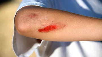 Should you put a bandaid on a cut immediately?