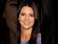 All Plastic Surgeries Of Kendall Jenner