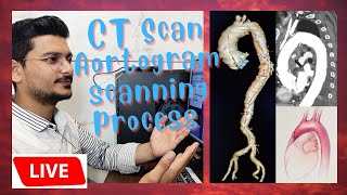 live CT Scan Aortogram scanning process and techniques | scanning process of Aortic Angiography.