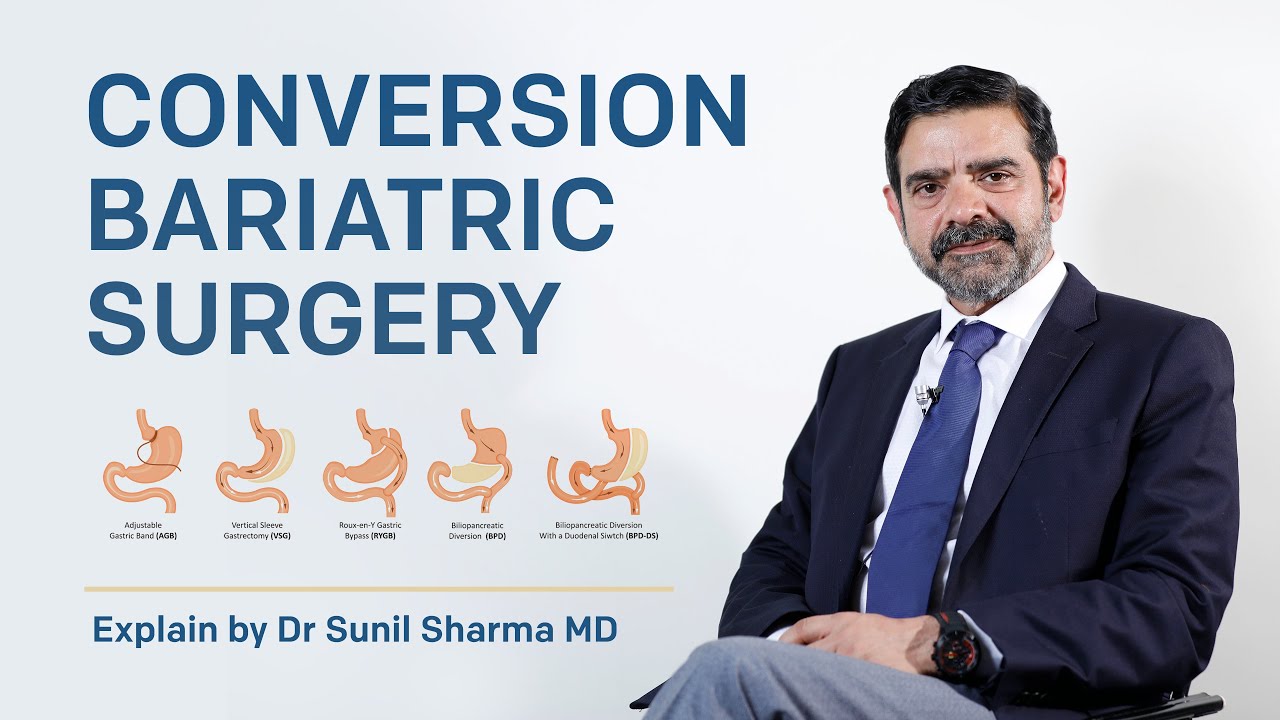 Conversion Bariatric Surgery Explained by Dr Sunil Sharma