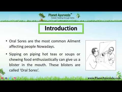 Top 5 Easy Home Remedies for Oral Sores