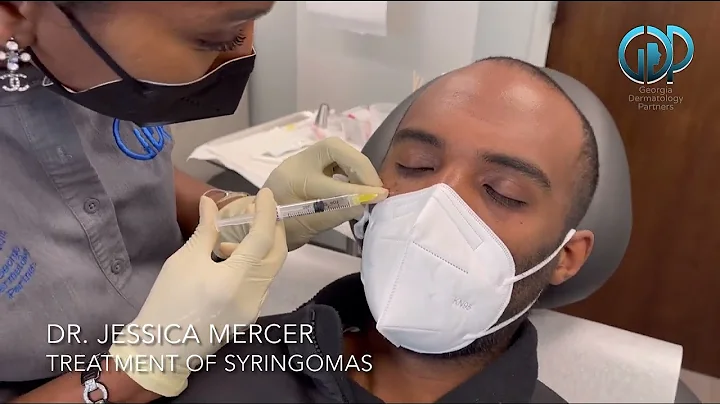Treatment of Syringomas with Dr. Jessica Mercer