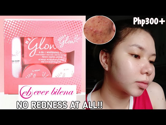 15 days Using HELLO GLOW KIT ✨ (Ever Bilena)  + Review | Best Skincare Set for Sensitive skin 😱 class=