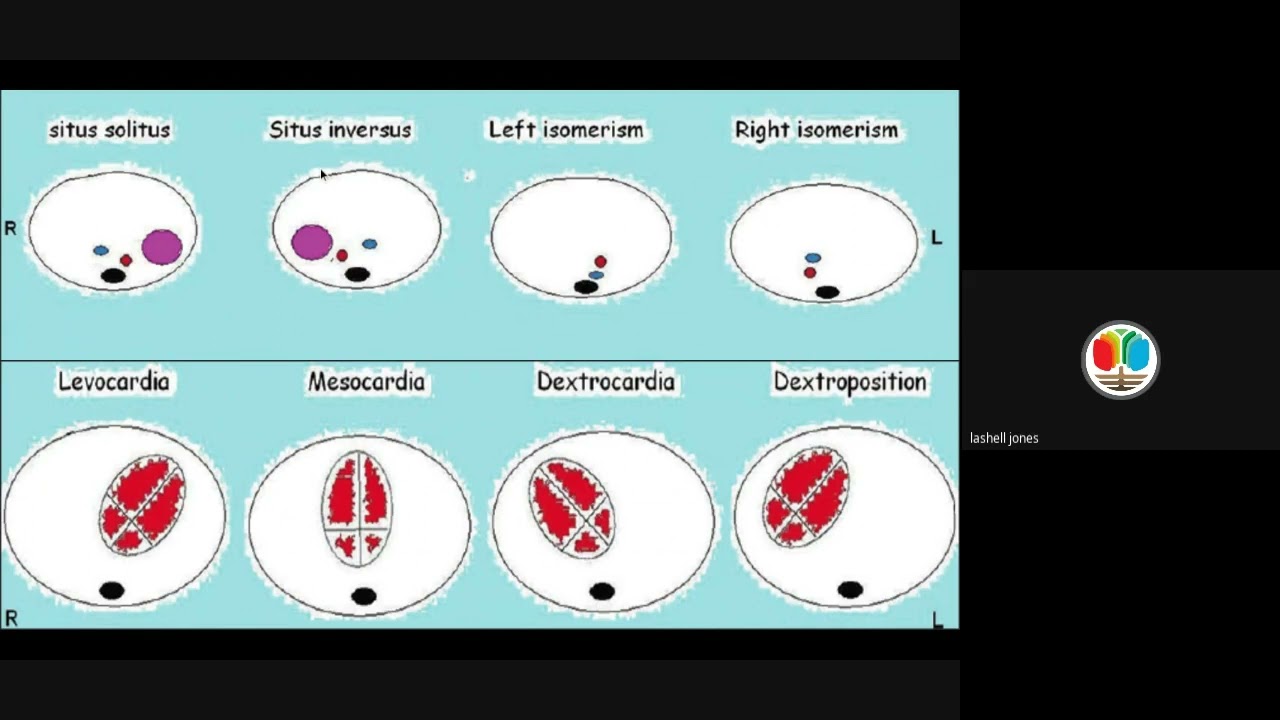 Lesson 4 Part 1: Fetal Heart Situs & Circulation (Start to Finish)
