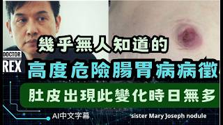 極度危險的腸胃病症狀，肚皮出現這變化時日無多