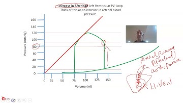 Cardiovascular Short Video:  PV-Loop Video #3 Increased Afterload