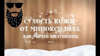 Шелушение от Миноксидила! Что делать?