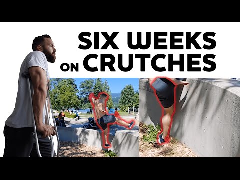 Knee Microfracture Recovery - Parkour | Part 1