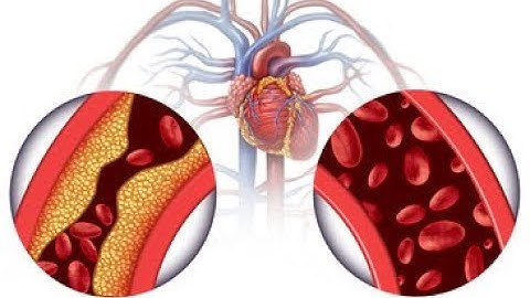 High Blood Pressure and Your Kidneys - A to Z Guide