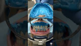 The Secret Process of Making Clear Braces! 🤯 #shortsusa  #dental #asmr #dentist #satisfying #teeth