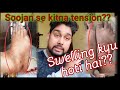 Swelling after surgery      what is compartment syndrome  swelling se kitni dikkat