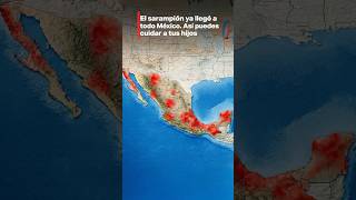 El Sarampión Ya Llegó A Todo México. Así Puedes Cuidar A Tus Hijos.