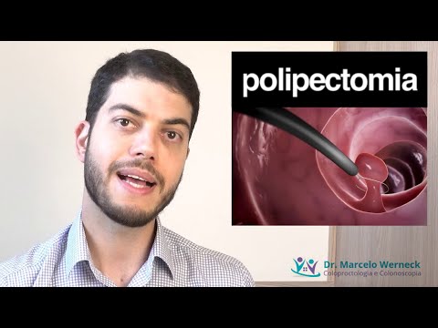 Como é a retirada de pólipos intestinais?